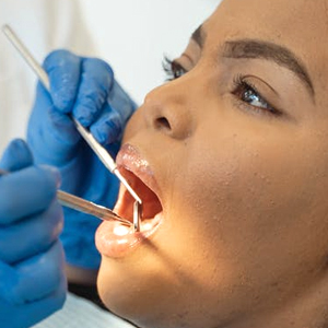 Non-Surgical Periodontal Treatment